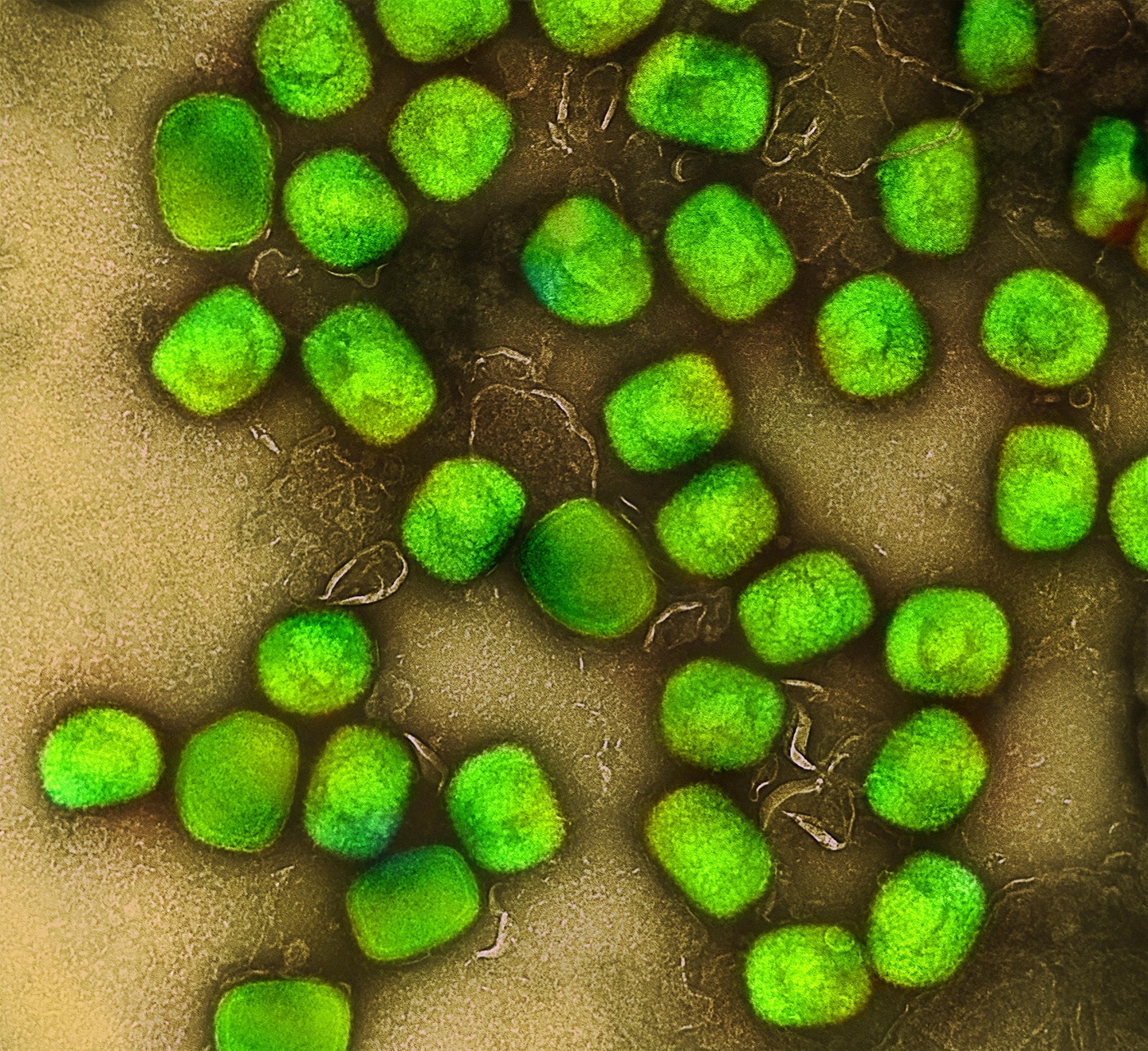 monkeypox-cme-course-prepares-medical-professionals