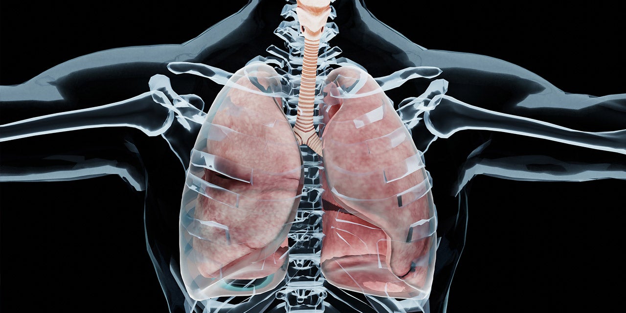 Chest Tube For Pneumothorax